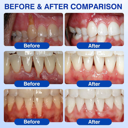 🏅🦷🛡️Jous® GumRevive Periodontal Repair Gel 🦠