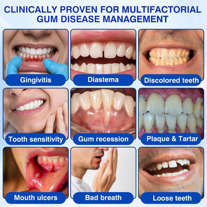 🏅🦷🛡️Jous® GumRevive Periodontal Repair Gel 🦠