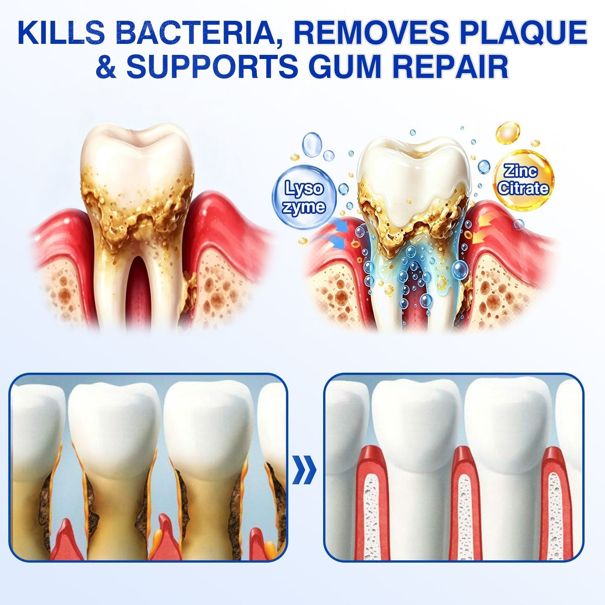 🏅🦷🛡️Jous® GumRevive Periodontal Repair Gel 🦠