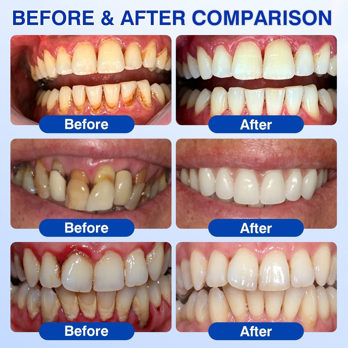 🏅🦷🛡️Jous® GumRevive Periodontal Repair Gel 🦠
