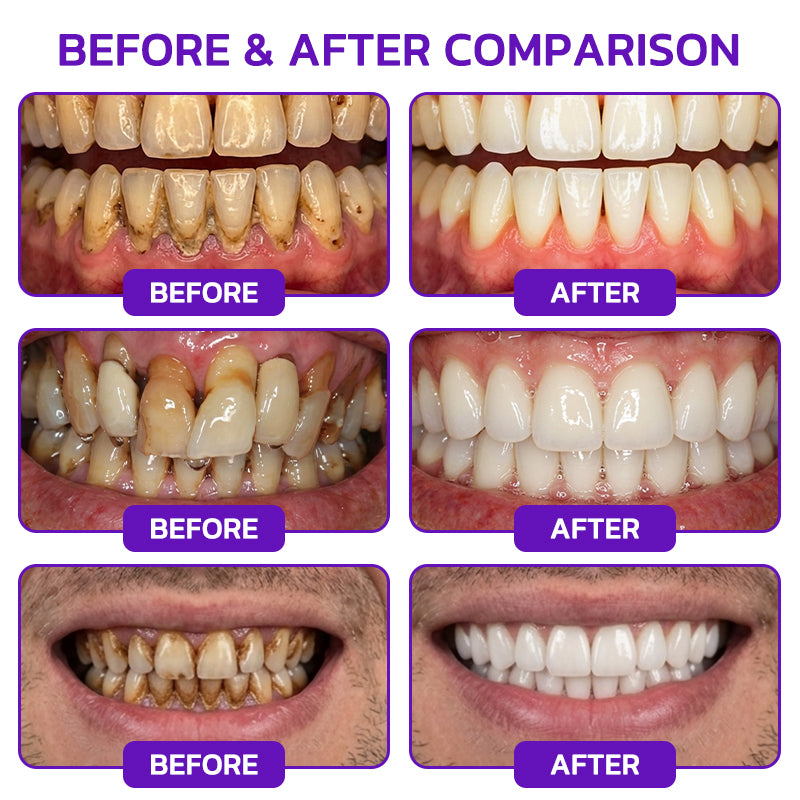 🦷JOUS® VioCore ✨ Bee Venom Gingivitis & Periodontitis Treatment Toothpaste