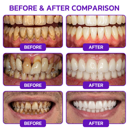 🦷JOUS® VioCore ✨ Bee Venom Gingivitis & Periodontitis Treatment Toothpaste