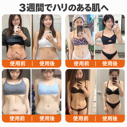 🔥 公式ブランドショップ丨Mrevbsin® ビーヴェノム プロ トータルクリーム—あらゆる肌タイプの引き締めケア