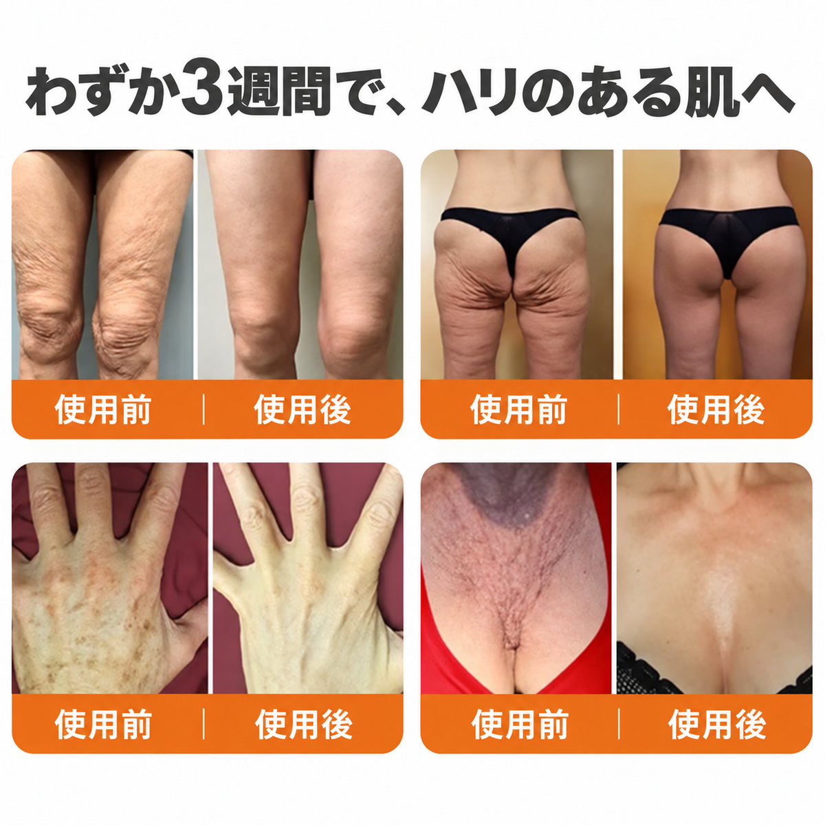 🔥 公式ブランドショップ丨Mrevbsin® ビーヴェノム プロ トータルクリーム—あらゆる肌タイプの引き締めケア