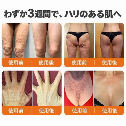 🔥 公式ブランドショップ丨Mrevbsin® ビーヴェノム プロ トータルクリーム—あらゆる肌タイプの引き締めケア