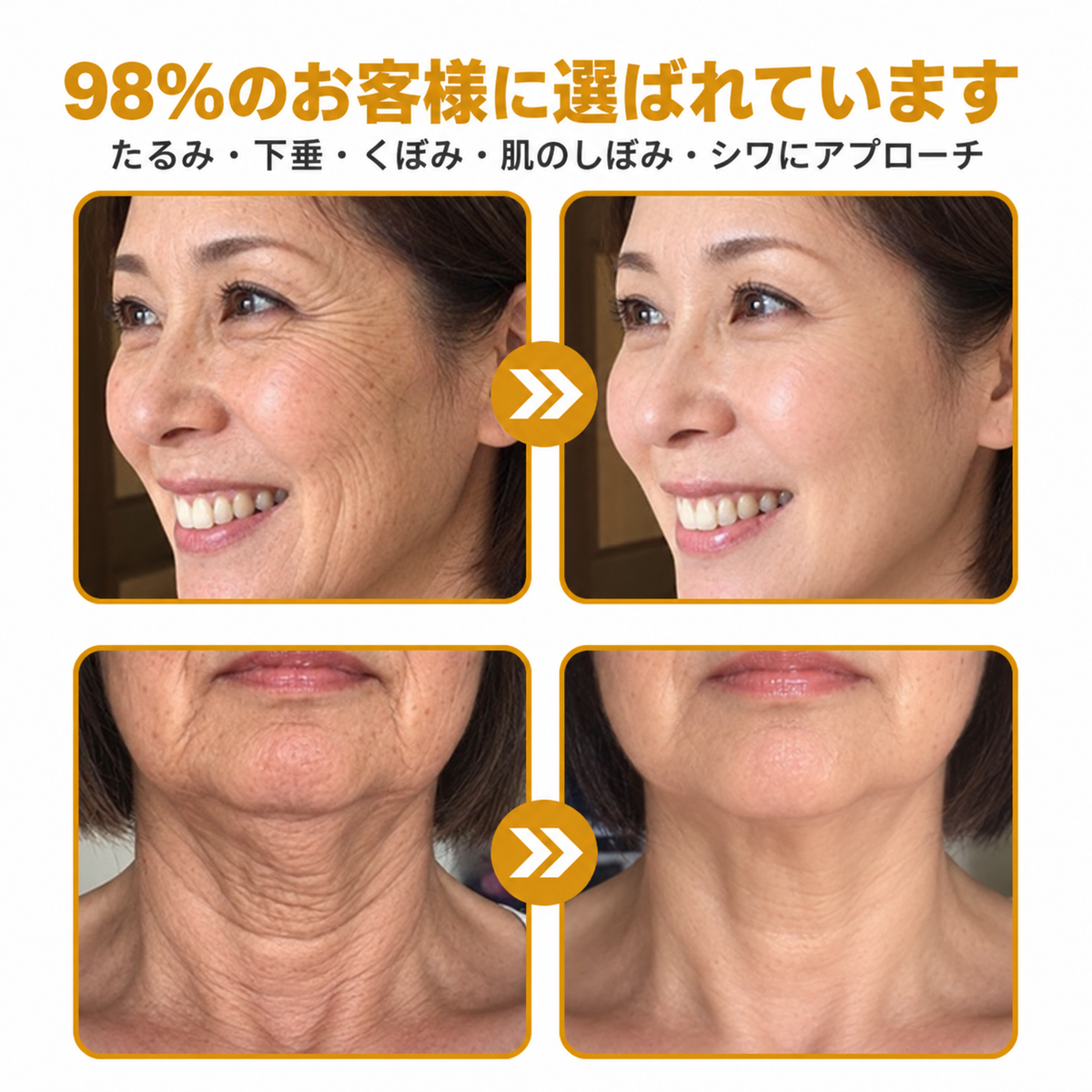 🔥 公式ブランドショップ丨Mrevbsin® ビーヴェノム プロ トータルクリーム—あらゆる肌タイプの引き締めケア
