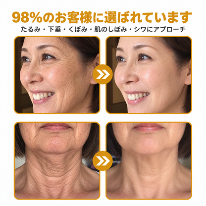 🔥 公式ブランドショップ丨Mrevbsin® ビーヴェノム プロ トータルクリーム—あらゆる肌タイプの引き締めケア