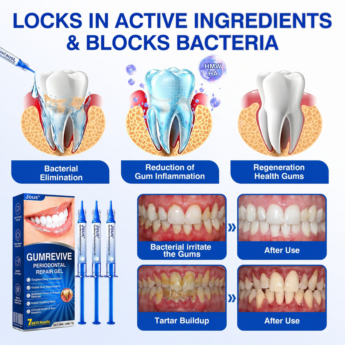 🏅🦷🛡️Jous® GumRevive Periodontal Repair Gel 🦠