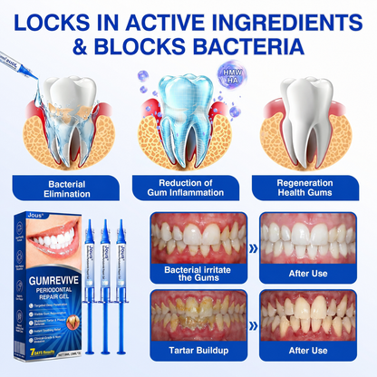 🏅🦷🛡️Jous® GumRevive Periodontal Repair Gel 🦠