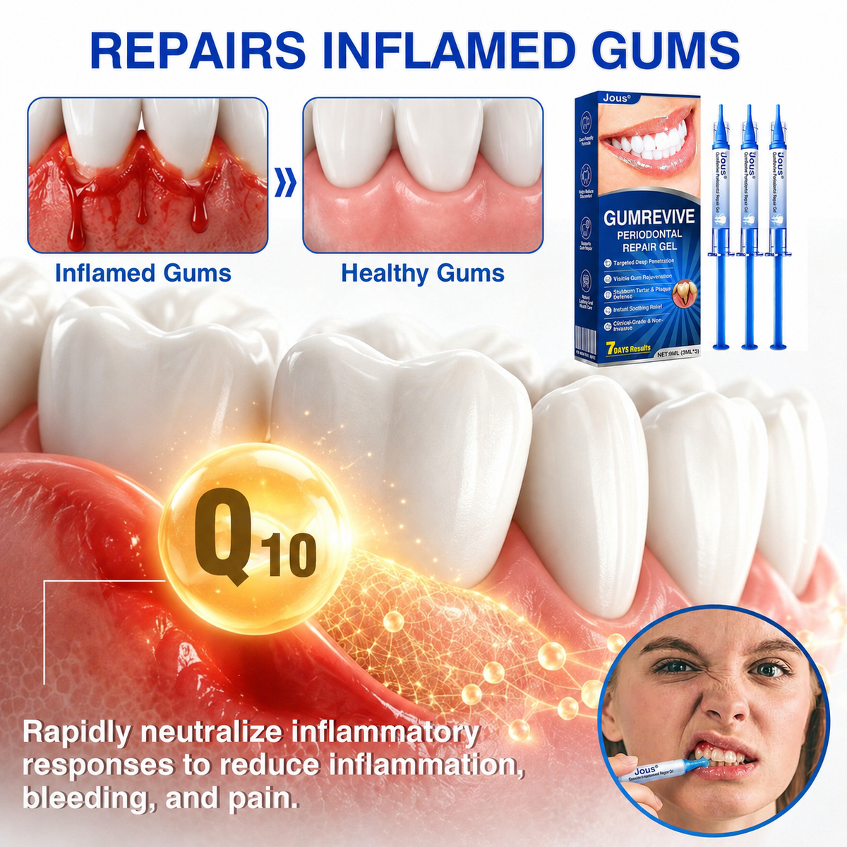 🏅🦷🛡️Jous® GumRevive Periodontal Repair Gel 🦠