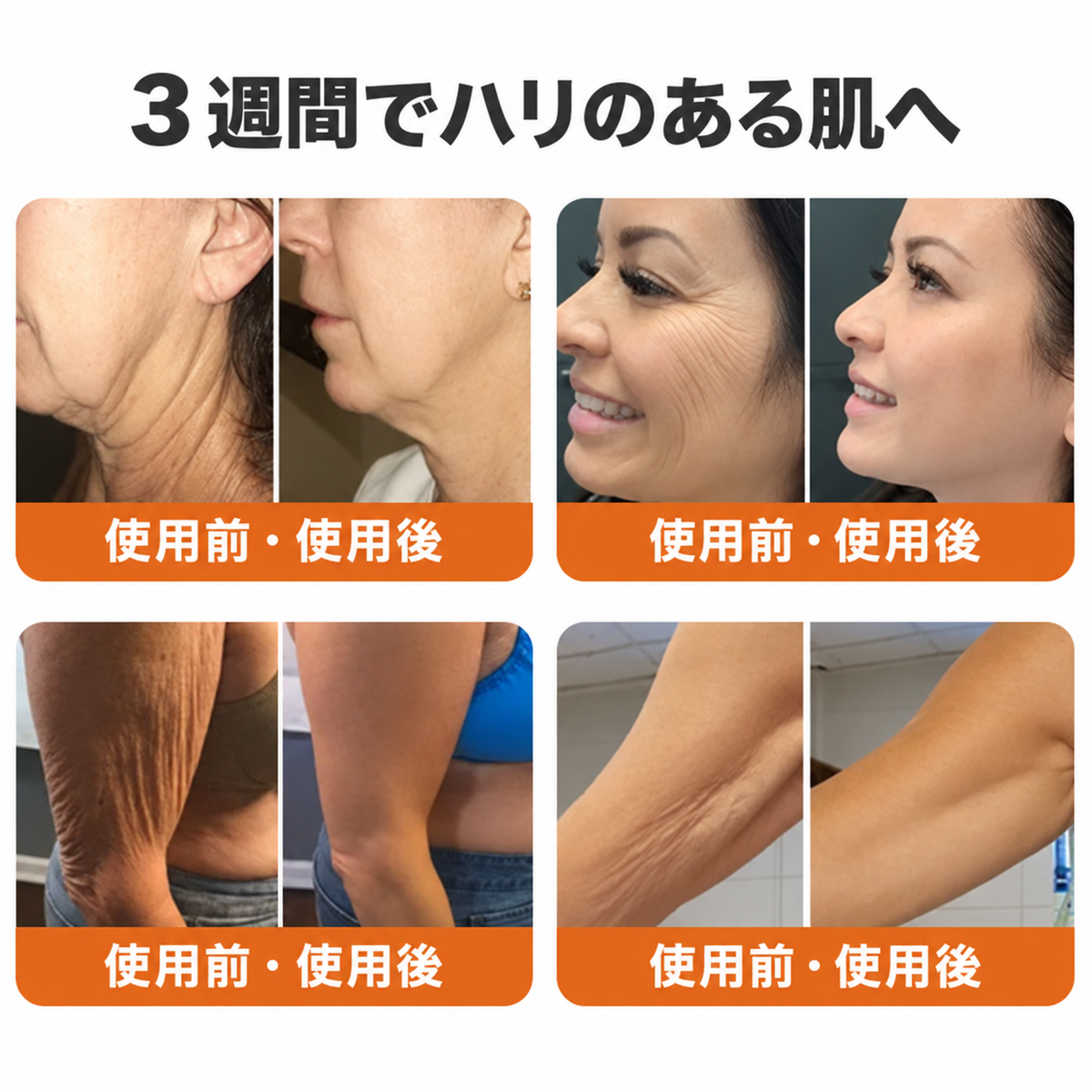 🔥 公式ブランドショップ丨Mrevbsin® ビーヴェノム プロ トータルクリーム—あらゆる肌タイプの引き締めケア