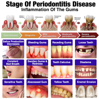 🦷JOUS® VioCore ✨ Bee Venom Gingivitis & Periodontitis Treatment Toothpaste